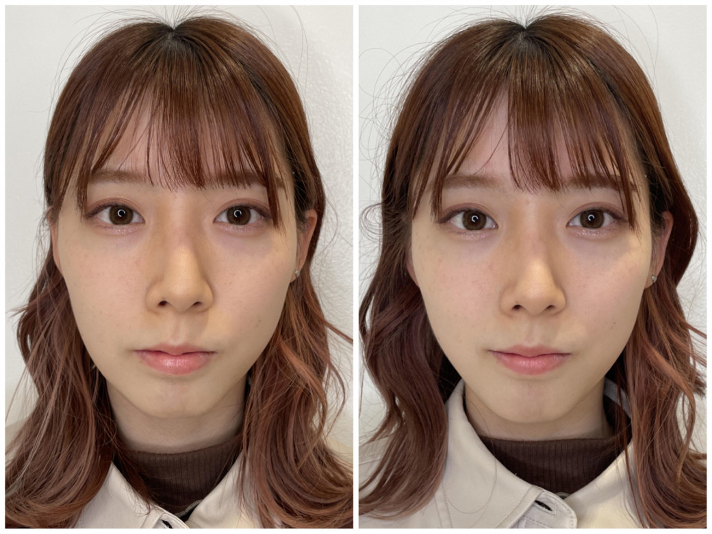 電気バリブラシ2.0 ヤーマン 美容/健康 美容機器 美容/健康 美容機器